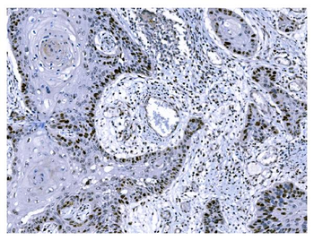 Ki67 Antibody (monoclonal, 5C7)