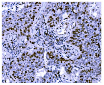 Ki67 Antibody (monoclonal, 5C7)