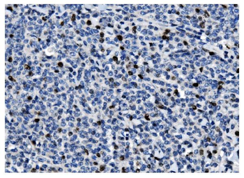Ki67 Antibody (monoclonal, 5C7)