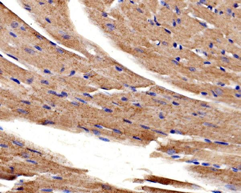 ACTN2 Rabbit Polyclonal Antibody
