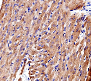 ACTN2 Rabbit Polyclonal Antibody