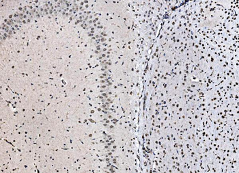 DBC-1/CCAR2/DBC Rabbit Polyclonal Antibody