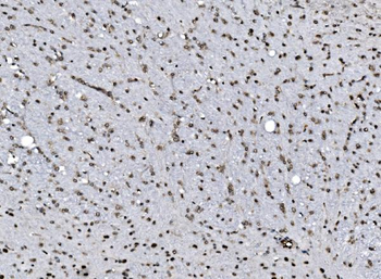 DBC-1/CCAR2/DBC Rabbit Polyclonal Antibody