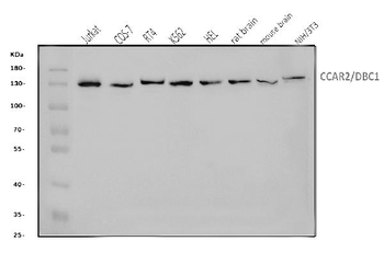 DBC-1/CCAR2/DBC Rabbit Polyclonal Antibody
