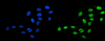 DBC-1/CCAR2/DBC Rabbit Polyclonal Antibody