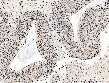 DBC-1/CCAR2/DBC Rabbit Polyclonal Antibody