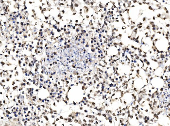 DBC-1/CCAR2/DBC Rabbit Polyclonal Antibody
