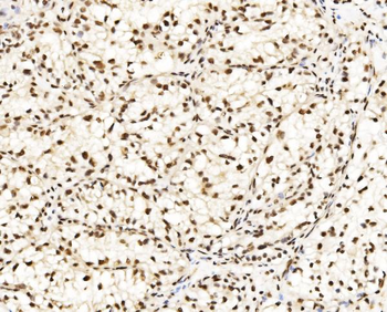 DBC-1/CCAR2/DBC Rabbit Polyclonal Antibody
