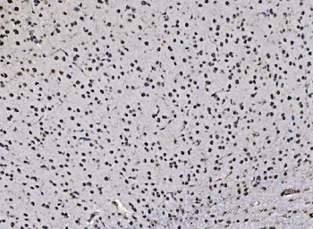 DBC-1/CCAR2/DBC Rabbit Polyclonal Antibody