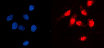 GCKR Rabbit Polyclonal Antibody