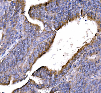 GGA3 Rabbit Polyclonal Antibody