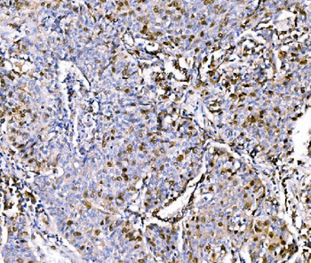 Geminin/GMNN Rabbit Polyclonal Antibody