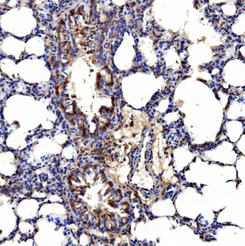 Gephyrin/GPHN Rabbit Polyclonal Antibody