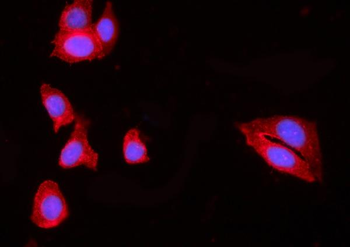HIP1R Rabbit Polyclonal Antibody