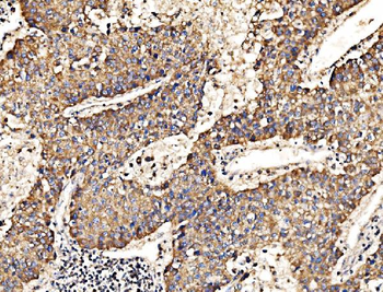 HIP1R Rabbit Polyclonal Antibody