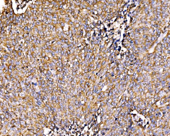 HIP1R Rabbit Polyclonal Antibody