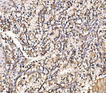 HIP1R Rabbit Polyclonal Antibody