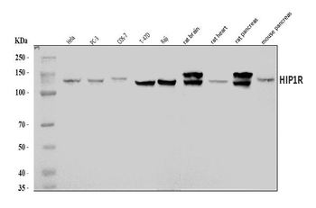 HIP1R Rabbit Polyclonal Antibody