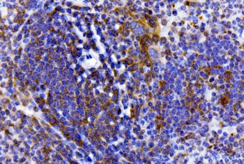 IL-2 Receptor alpha/Il2ra/IL Rabbit Polyclonal Antibody
