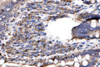 IL-2 Receptor alpha/Il2ra/IL Rabbit Polyclonal Antibody