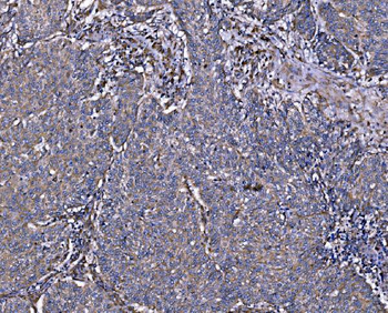 Integrin linked ILK Antibody