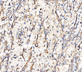 Integrin linked ILK Antibody