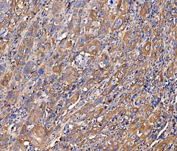SCRN1 Rabbit Polyclonal Antibody