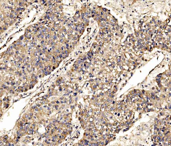 SCRN1 Rabbit Polyclonal Antibody
