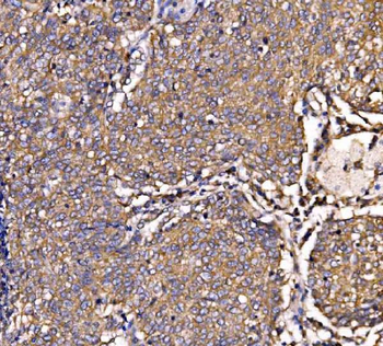 SCRN1 Rabbit Polyclonal Antibody