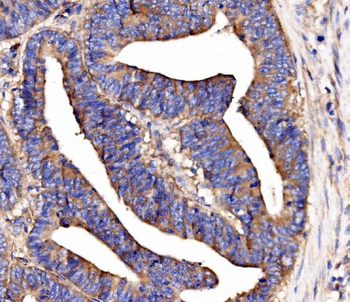 SCRN1 Rabbit Polyclonal Antibody