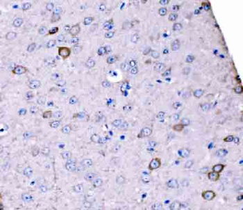 SCRN1 Rabbit Polyclonal Antibody