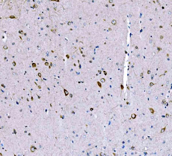SCRN1 Rabbit Polyclonal Antibody