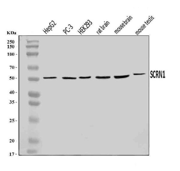 SCRN1 Rabbit Polyclonal Antibody