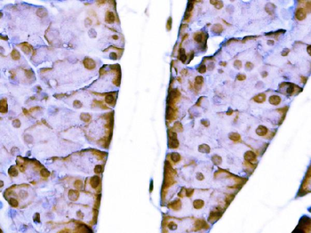 Sox11 Rabbit Polyclonal Antibody