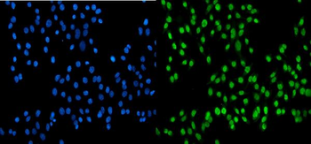 SSB Rabbit Polyclonal Antibody