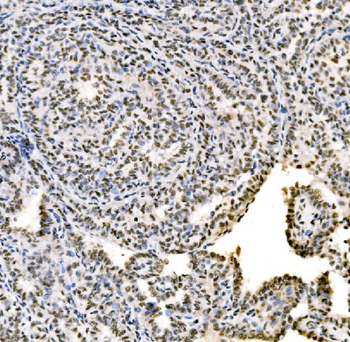 SSB Rabbit Polyclonal Antibody