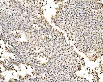 SSB Rabbit Polyclonal Antibody