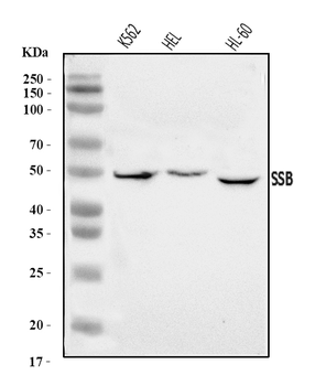 SSB Rabbit Polyclonal Antibody