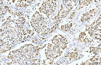 Cyclophilin E/PPIE Mouse Monoclonal Antibody