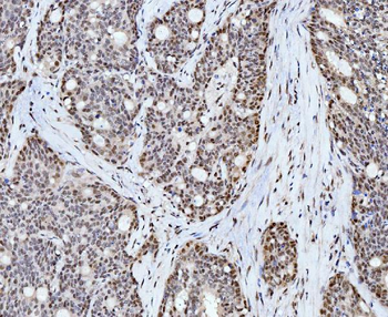 Cyclophilin E/PPIE Mouse Monoclonal Antibody