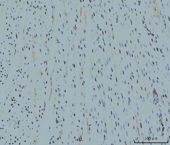 Cyclophilin E/PPIE Mouse Monoclonal Antibody