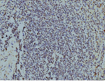 LSM8 Antibody (monoclonal, 6B11)