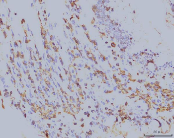 EIF4A1 Antibody (monoclonal, 3F11)