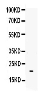 Interleukin-6 IL6 Rabbit Polyclonal Antibody