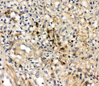 Interleukin-10 IL10/10 Rabbit Polyclonal Antibody