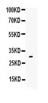 IL17/IL17A Rabbit Polyclonal Antibody