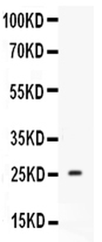 Prolactin Prl Rabbit Polyclonal Antibody