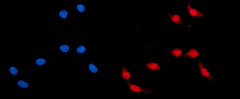 ADRM1/ARM-1/ARM Rabbit Polyclonal Antibody