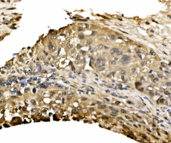 ADRM1/ARM-1/ARM Rabbit Polyclonal Antibody