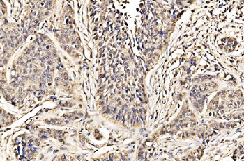 ADRM1/ARM-1/ARM Rabbit Polyclonal Antibody